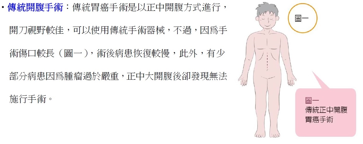 傳統開腹手術
