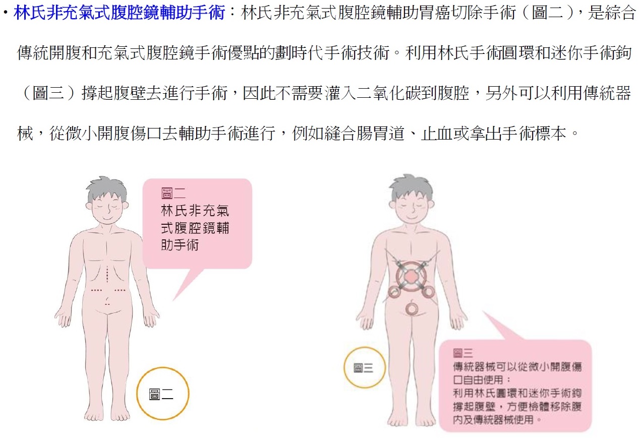 林氏非充氣式腹腔鏡輔助手術