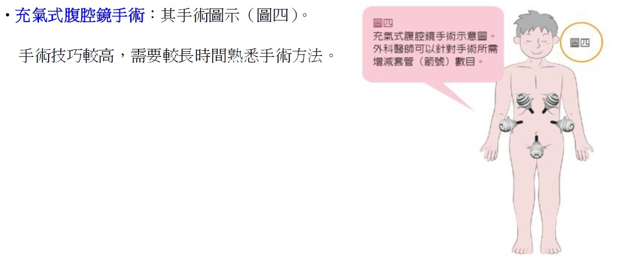 充氣式腹腔鏡手術
